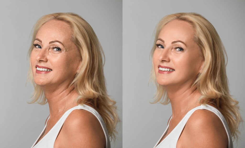 Before after Image-Fredericksburg, VA