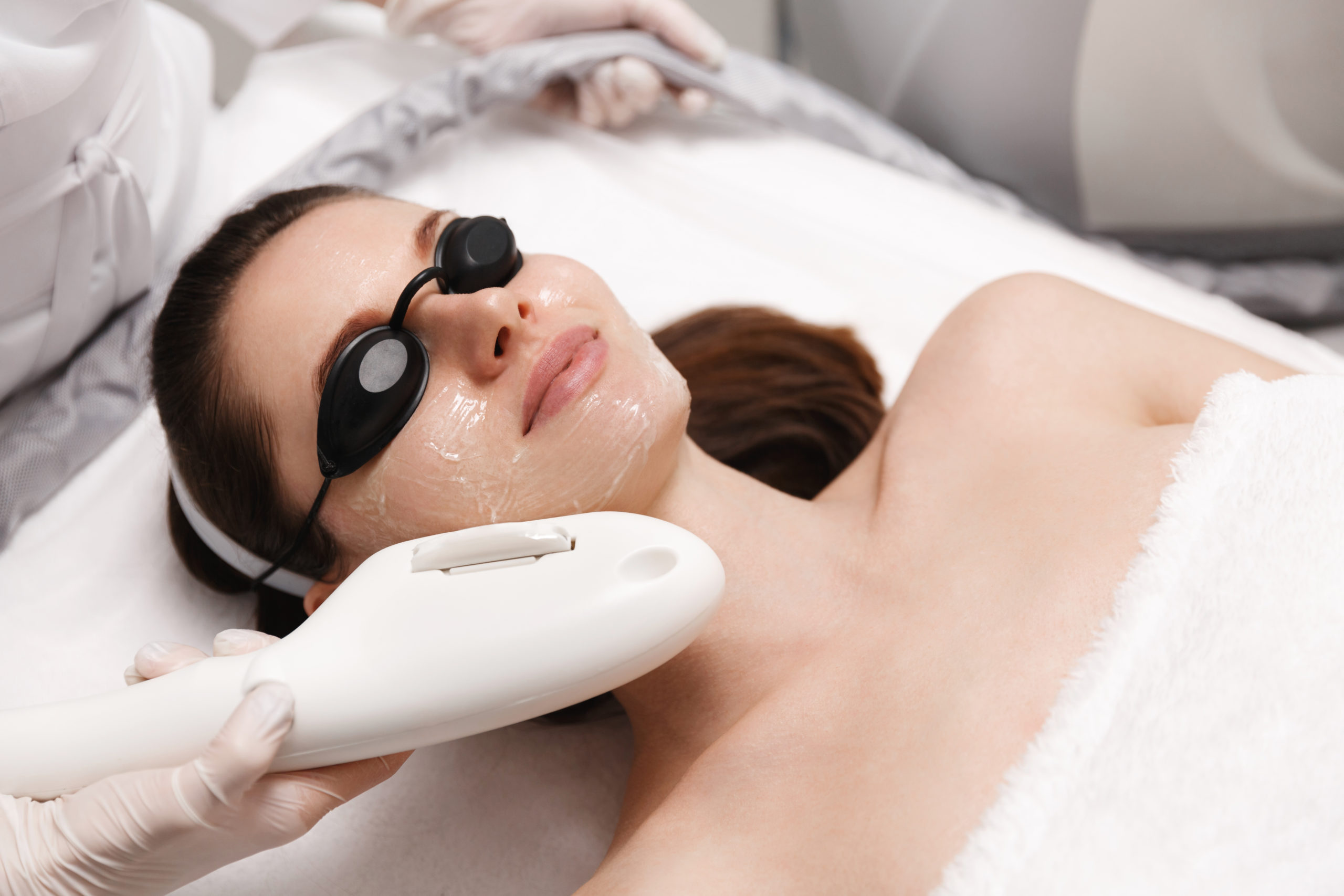 Photofacial by Revive Med Aesthetics in Cowan Blvd Fredericksburg VA