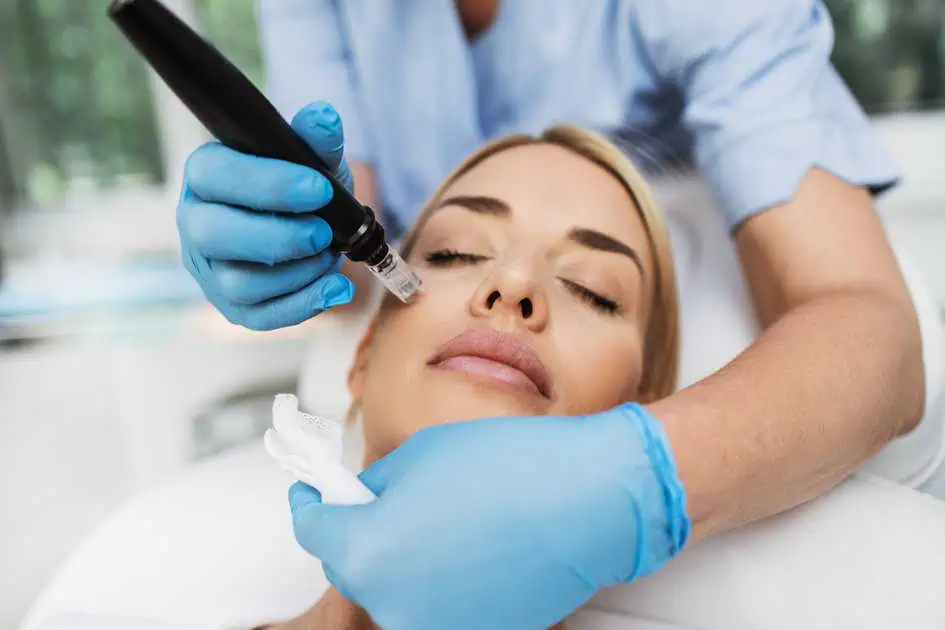 Microneedling Treatment In Fredericksburg, VA by Revive Med Aesthetics