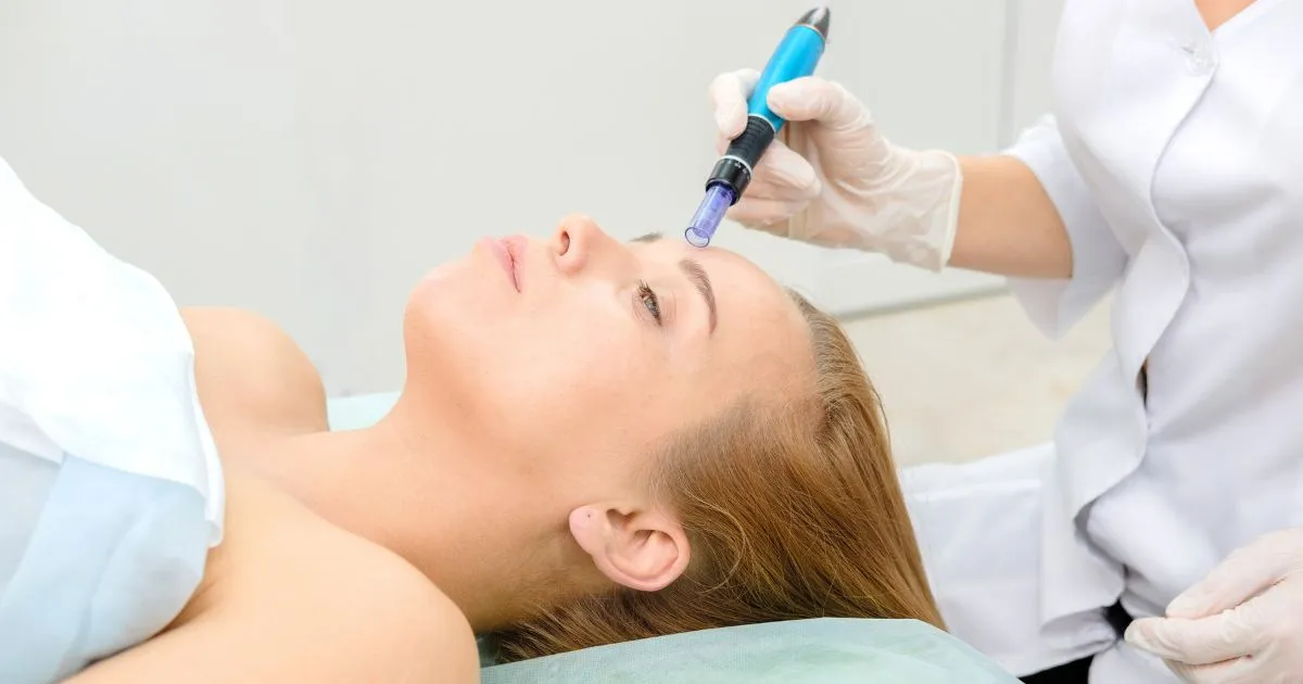 Close-up of a patient examining mild acne scars and blemishes, a common concern addressed by Microneedling for acne scars